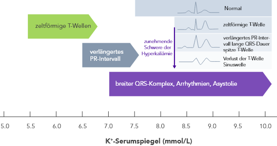 Progressive ECG changes with increasing severity of hyperkalaemia