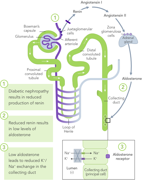 Diagram: diabetic nephropathy leads to reduced renin and lower K+ excretion