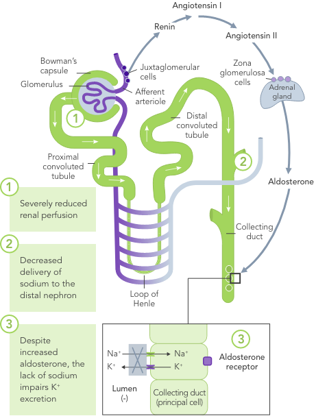 Diagram: Heart failure-induced hyperkalaemia