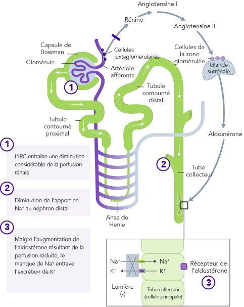 Diagram: reduced renal perfusion results in impaired K+ excretion