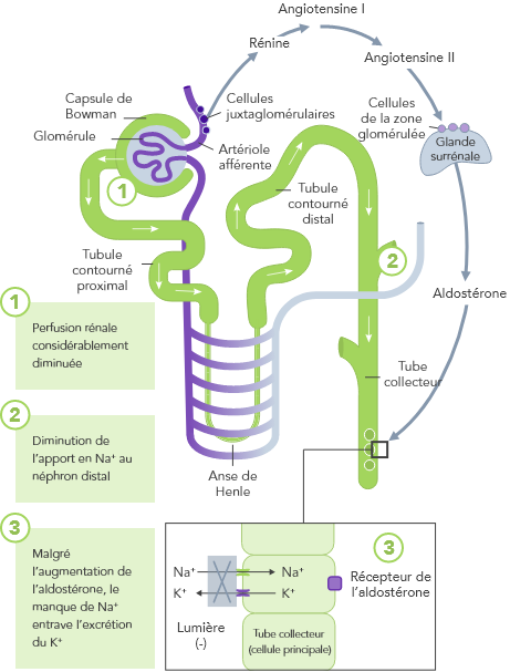 Diagram: Heart failure-induced hyperkalaemia