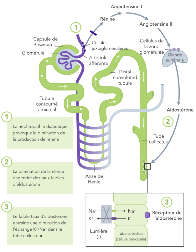 Diagram: diabetic nephropathy leads to reduced renin and lower K+ excretion